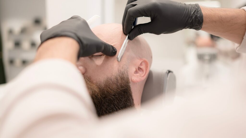 Head Shaving Guide 2 Head shaving guide and scalp care